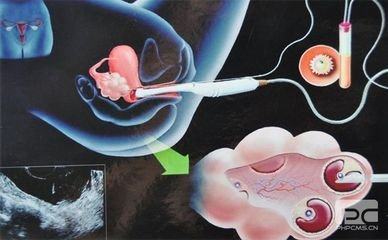 方鉴生殖医学中心